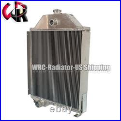 Radiator fits John Deere 300B 301A 302 302A 401 401B/C 1035 1520 AT48171 AT28583